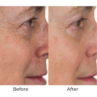 Conture Skin Toning System - Try Before You Buy Image - 71