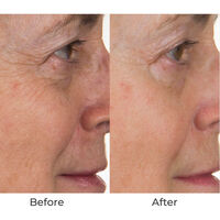 Conture Kinetic Skin Toning System with Treatment Serum Image - 71