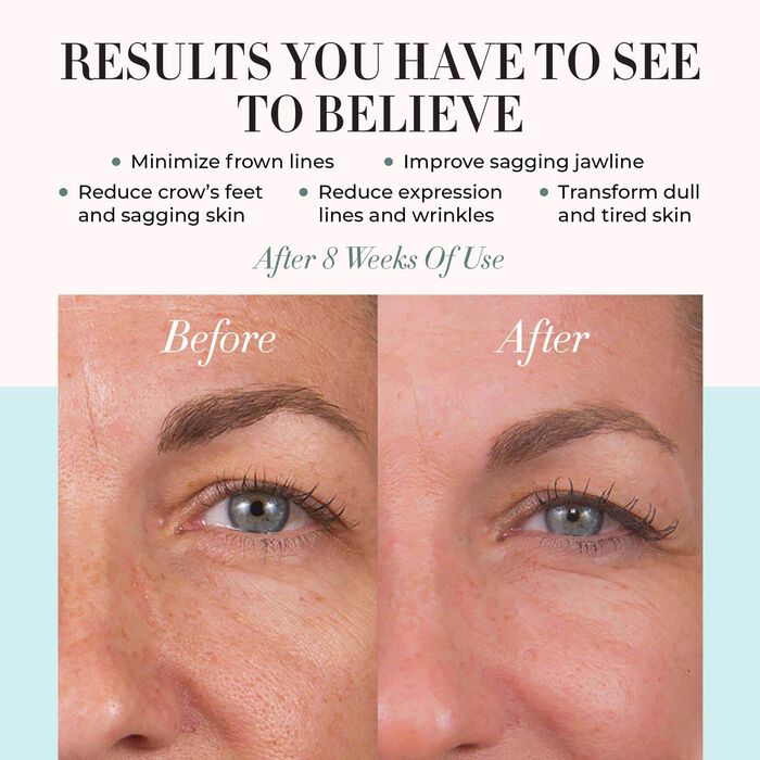 Conture CT Skin Toning System