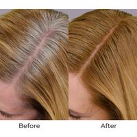 Breeze2 Airbrush Haircare Root & Hair Upgrade Kit Image - 141