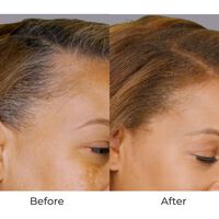 Breeze2 Airbrush Haircare Root & Hair Upgrade Kit - Blonde Image - 161