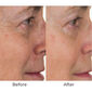 Conture CT Skin Toning System image number null