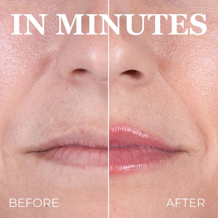 Before and after image showing visibly plumper, smoother, and more hydrated lips after using Hot Kiss Lip Plumper