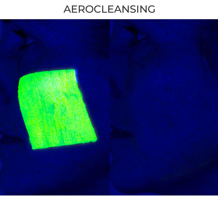 Aerocleanse Facial Cleansing Device Green MetallicGreen Metallic