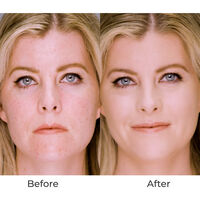 Rose 4-in-1 Airbrush Foundation Image - 2