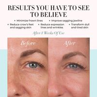 Conture Kinetic Skin Toning System with Treatment Serum Image - 51