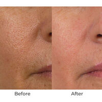 Conture Kinetic Skin Toning System with Treatment Serum Image - 61