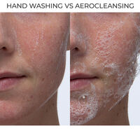 Aerocleanse Facial Cleansing Device Image - 71