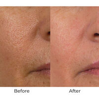 Conture CT Skin Toning System Image - 7