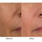 Conture CT Skin Toning System image number null
